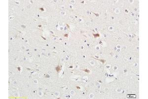 Formalin-fixed and paraffin embedded rat liver tissue labeled with Anti-ABHD5 Polyclonal Antibody, Unconjugated (ABIN708596) at 1:200 followed by conjugation to the secondary antibody and DAB staining (ABHD5 Antikörper  (AA 281-349))