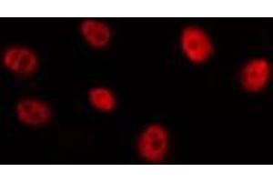 ABIN6275127 staining HepG2 by IF/ICC. (FOXB2 Antikörper  (Internal Region))