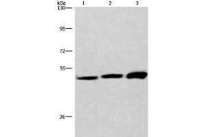 Western Blot analysis of adrenal pheochromocytoma tissue,Jurkat and A549 cell using VWA5A Polyclonal Antibody at dilution of 1:275 (VWA5A Antikörper)