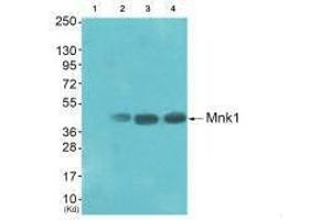 Western blot analysis of extracts from HepG2 cells (Lane 2), K562 cells (Lane 3) and Jurket cells (Lane 4), using Mnk1 (Ab-385) antiobdy. (MKNK1 Antikörper  (Thr385))