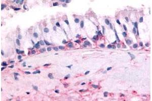 Immunohistochemical (Formalin/PFA-fixed paraffin-embedded sections) staining in human nasal mucosa, respiratory epithelium with OR10J5 polyclonal antibody . (OR10J5 Antikörper  (2nd Extracellular Domain))