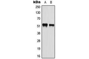 Western blot analysis of ATF2 (pS112) expression in HeLa (A), A549 (B) whole cell lysates. (ATF2 Antikörper  (pSer112))