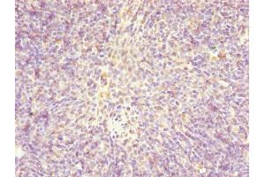 Immunohistochemistry of paraffin-embedded human thymus tissue using ABIN7147370 at dilution of 1:100 (Centromere Protein X (CENPX) (AA 1-63) Antikörper)
