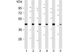 Western blot testing of 1) human 293, 2) (h) HeLa, 3) (h) MDA-MB-231, 4) rat H-4-II-E, 5) (h) HCT-116 and 6) mouse C2C12 cell lysate with TBP antibody at 1:2000. (TBP Antikörper)