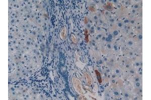 Detection of CASP4 in Human Liver Tissue using Polyclonal Antibody to Caspase 4 (CASP4) (Caspase 4 Antikörper  (AA 290-377))