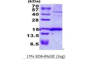 Image no. 1 for Signal Sequence Receptor, delta (SSR4) protein (His tag) (ABIN1098708) (SSR4 Protein (His tag))