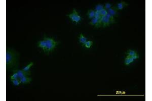Immunofluorescence of monoclonal antibody to MCAM on JAR cell . (MCAM Antikörper  (AA 24-646))