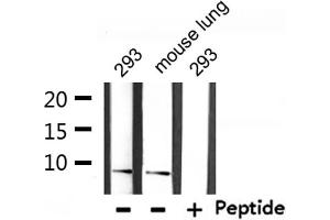 Western blot analysis of extracts from 293 and mouse lung, using Ubiquitin Antibody. (UBA52 Antikörper  (Internal Region))