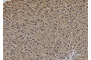 ABIN6276878 at 1/100 staining Mouse liver tissue by IHC-P. (Dynactin 1 Antikörper  (C-Term))