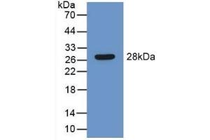 Detection of Recombinant LEI, Mouse using Polyclonal Antibody to Leukocyte Elastase Inhibitor (LEI) (SERPINB1 Antikörper  (AA 184-368))