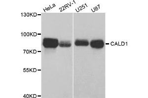 Western blot analysis of extracts of various cell lines, using CALD1 antibody (ABIN5973102) at 1/1000 dilution. (Caldesmon Antikörper)