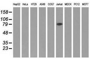 Image no. 1 for anti-Aldehyde Dehydrogenase 1 Family, Member L1 (ALDH1L1) antibody (ABIN1496581) (ALDH1L1 Antikörper)