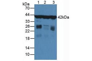 Figure. (Actin, gamma 1 Antikörper  (AA 1-375))