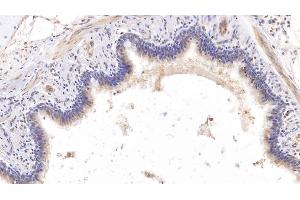 Detection of COL8a1 in Human Lung Tissue using Monoclonal Antibody to Collagen Type VIII Alpha 1 (COL8a1) (COL8A1 Antikörper  (AA 575-743))