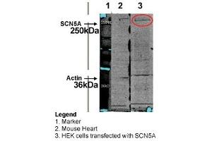 WB Suggested Anti-SCN5A Antibody Titration: HEK cel lysate; HEK cel with HuNav1. (SCN5A Antikörper  (C-Term))