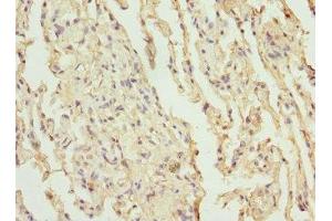 Immunohistochemistry of paraffin-embedded human lung tissue using ABIN7147382 at dilution of 1:100 (Precursor of CEP12 (AT1G31670) (AA 1-270) Antikörper)