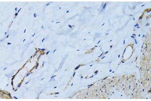 Immunohistochemistry of paraffin-embedded Human colon using MCAM Polyclonal Antibody at dilution of 1:100 (40x lens). (MCAM Antikörper)