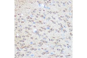 Immunohistochemistry of paraffin-embedded rat brain using Huntingtin Rabbit pAb (ABIN7267794) at dilution of 1:100 (40x lens). (Huntingtin Antikörper)