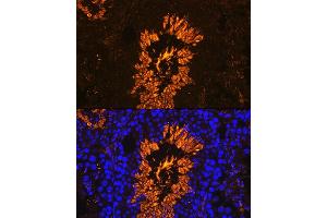 Immunofluorescence analysis of Mouse testis using  antibody (ABIN7265353) at dilution of 1:100. (AKAP4 Antikörper  (AA 189-340))