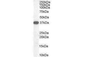 Image no. 1 for anti-Dimethylarginine Dimethylaminohydrolase 1 (DDAH1) (C-Term) antibody (ABIN374149) (DDAH1 Antikörper  (C-Term))