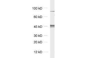 dilution: 1 : 5000, sample: rat brain homogenate (Cytohesin 2 Antikörper)