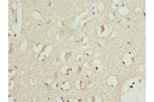 Immunohistochemistry of paraffin-embedded human brain tissue using ABIN7164274 at dilution of 1:100 (PITRM1 Antikörper  (AA 758-1037))