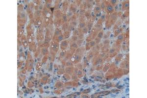 IHC-P analysis of Human Tissue, with DAB staining.