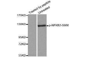 Western blot analysis of extracts from ovary cancer cells, using Phospho-NFKB2-S866 antibody (ABIN2988214). (NFKB2 Antikörper  (pSer866))
