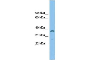 WB Suggested Anti-AKR1C2 Antibody Titration: 0. (AKR1C2 Antikörper  (N-Term))