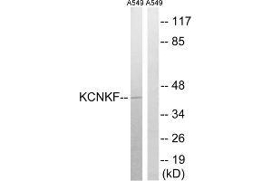 Western blot analysis of extracts from A549 cells, using KCNK15 antibody. (KCNK15 Antikörper  (C-Term))