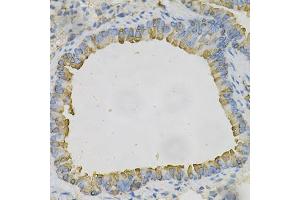 Immunohistochemistry of paraffin-embedded mouse lung using AZGP1 Antibody (ABIN1876553) at dilution of 1:100 (40x lens). (AZGP1 Antikörper)