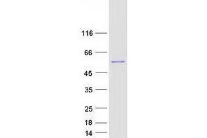 Western Blotting (WB) image for UDP-Glucose Pyrophosphorylase 2 (UGP2) (Transcript Variant 2) protein (Myc-DYKDDDDK Tag) (ABIN2734987)