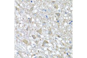 Immunohistochemistry of paraffin-embedded rat brain using VPS37A antibody.