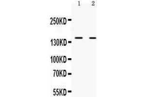 Observed bind size: 150KD (NRIP1 Antikörper  (N-Term))