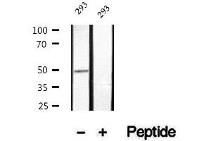 Western blot analysis of extracts of 293 cells, using Phospho-Cyclin E1 (Thr77) Antibody.