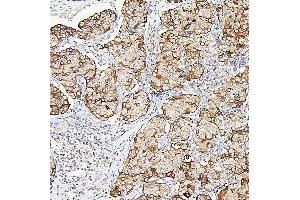 IHC analysis of ALDOA using anti-ALDOA antibody (ABIN7601907). (ALDOA Antikörper  (AA 50-364))