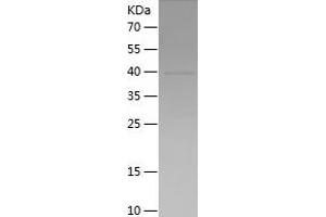 TLR9 Protein (AA 857-1032) (His-IF2DI Tag)