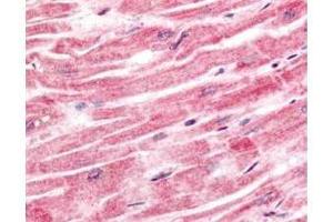 Immunohistochemistry of Rabbit anti-Sprouty-4 antibody. (SPRY4 Antikörper  (AA 275-299))