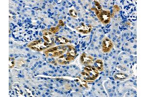 ABIN6264652 and ABIN6266628 at 1/100 staining Mouse kidney tissue by IHC-P. (RASH/RASK/RASN (N-Term) Antikörper)