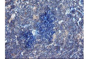 Image no. 4 for anti-Dual Specificity Phosphatase and Pro Isomerase Domain Containing 1 (DUPD1) antibody (ABIN1497927)