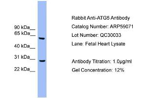 WB Suggested Anti-ATG5  Antibody Titration: 0.