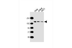 All lanes : Anti-MYBBP1A Antibody at 1:5000 dilution Lane 1: Hela whole cell lysate Lane 2: Jurkat whole cell lysate Lane 3: A431 whole cell lysate Lysates/proteins at 20 μg per lane. (MYBBP1A Antikörper  (AA 1104-1328))
