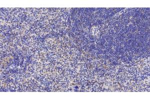 Detection of LY96 in Mouse Spleen Tissue using Polyclonal Antibody to Lymphocyte Antigen 96 (LY96) (LY96 Antikörper  (AA 16-160))