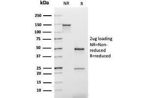 SDS-PAGE Analysis Purified Kappa Light Chain Mouse Recombinant Monoclonal Ab (rL1C1). (Rekombinanter IGKC Antikörper)