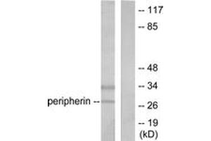 Western blot analysis of extracts from 293 cells, using PGP9. (UCHL1 Antikörper  (AA 171-220))