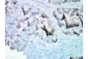 Immunohistochemistry analysis using Mouse Anti-Hsp60 Monoclonal Antibody, Clone LK-2 (ABIN361786 and ABIN361787). (HSPD1 Antikörper)