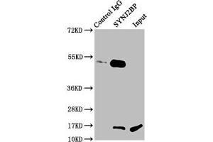 Immunoprecipitating SYNJ2BP in Rat kidney tissue Lane 1: Rabbit control IgG instead of ABIN7171128 in Rat kidney tissue. (SYNJ2BP Antikörper  (AA 1-117))