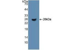 Western Blotting (WB) image for Aconitase 1 (ACO1) ELISA Kit (ABIN6720599)