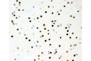 IHC-P testing of rat brain tissue (MSK1 Antikörper  (AA 540-665))