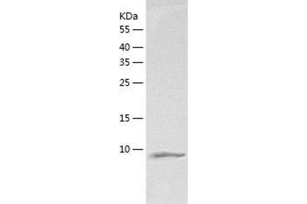ARPP19 Protein (AA 1-112) (His tag)
